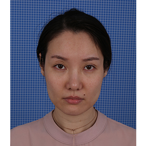 美萊案例于美眉對(duì)比圖后