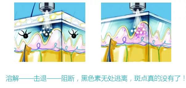 長(zhǎng)斑和大姨媽有沒有關(guān)聯(lián)？