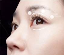 重慶常用的雙眼皮整形方法有哪些？