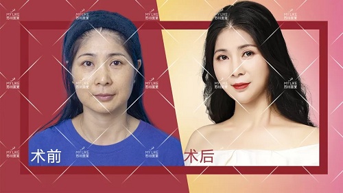 2019年的flag：悅美女人更悅美萊