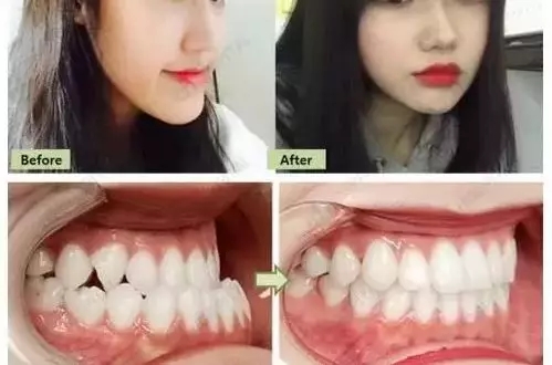 想要自信笑容，就來<a href='/suz/' target='_blank'><u>蘇州美萊</u></a>牙科
