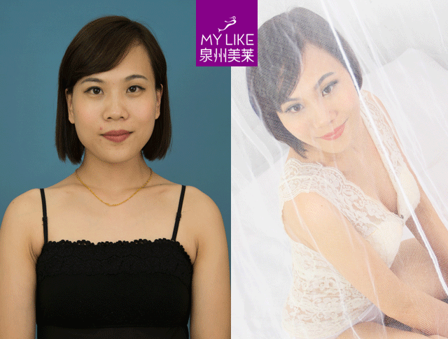 泉州美萊說：喂完下一代，酥胸變布袋？怎么解決