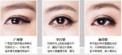 寧波做雙眼皮手術(shù)后眼睛腫脹怎么辦？