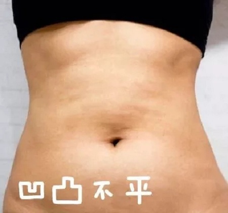 這個(gè)冬天，我“脂”在乎你，就來美萊吧
