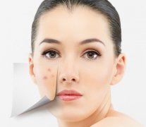 臉上長(zhǎng)痘怎么辦？