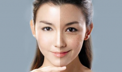 光子嫩膚價格是多少？