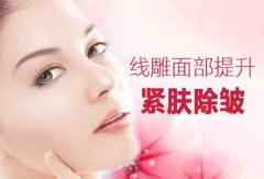 做線雕提升優(yōu)勢有那些呢？
