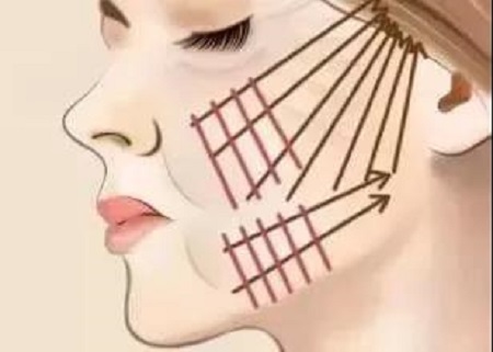 圍觀| 僅靠一條線，如何提升你的下垂臉？！