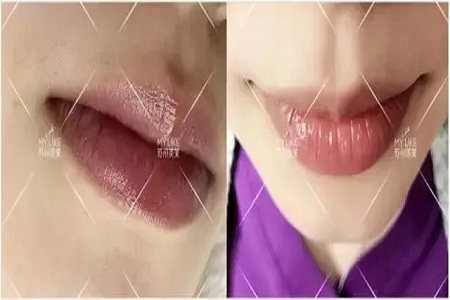 想過(guò)嗎？為啥有人的體毛多有的人少？