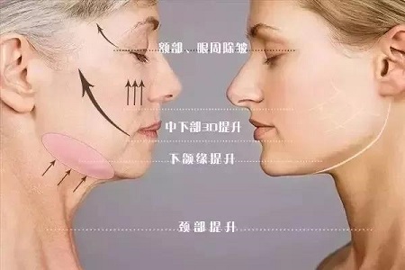 長了痘為啥消不下去！？