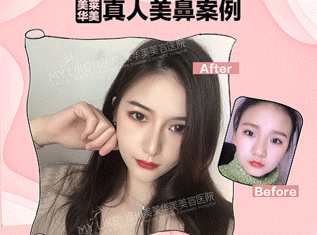 她曾丑到無人問津，現(xiàn)在卻擁有魔鬼身材，簡直是“行走的美人魚”