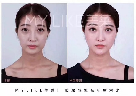 卻比喬妹還能收割男神？！