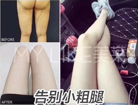 簡單幾招瘦小肚子，火速收藏！