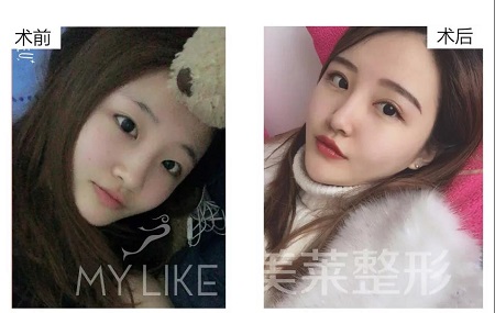 美萊特邀整形醫(yī)師—卜勝利主任，3月4日親診石家莊美萊。