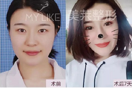有圖有真相！每一個(gè)單眼皮的妹子都是潛力股~