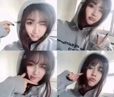 脂肪填充1周后，小喪臉竟嫩過少女！