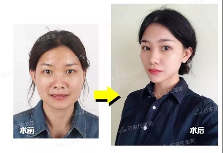 她們的眼睛做的，男神都會(huì)多看幾眼！