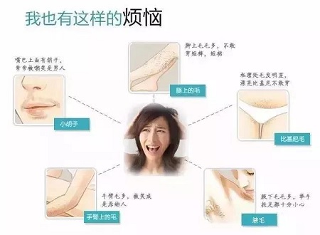 脫毛年卡38元起 |脫掉尷尬,秀出迷人好身材！