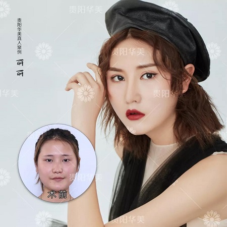 會(huì)縫衣服就會(huì)割雙眼皮！3天速成還用朋友試手？