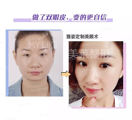 注意啦！這些眼睛一點都不招人喜歡！