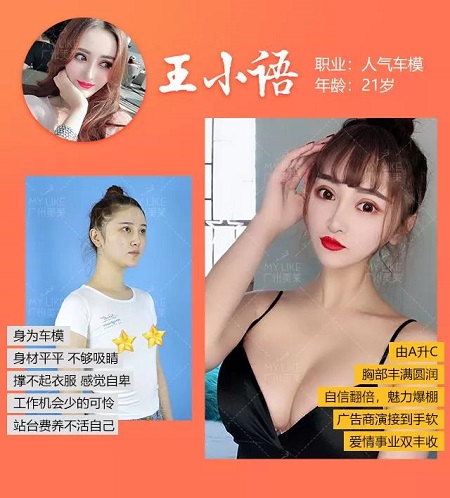 隆胸