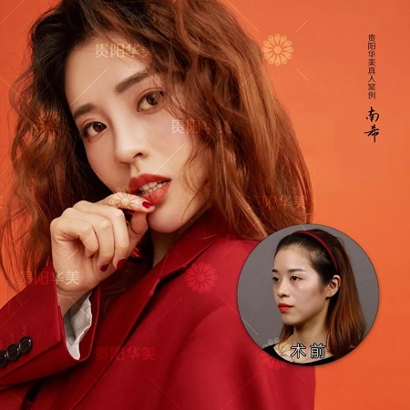 玻尿酸停打有危害嗎？打多了會(huì)怎樣？