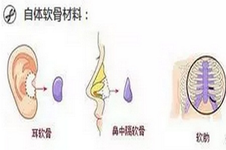 哪些人適合半肋，哪些人適合全肋？