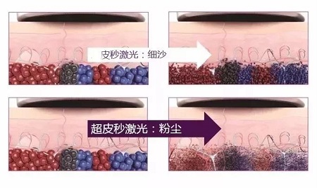 關(guān)于祛斑，可不能用美圖秀秀、輕顏相機(jī)、無(wú)他相機(jī)麻痹自己！