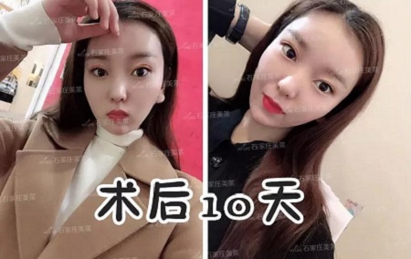 天天喊著要減肥！減肥！但，你真的胖嗎？