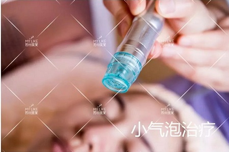 你知道臉上的黑頭和白頭是怎么形成的嗎？