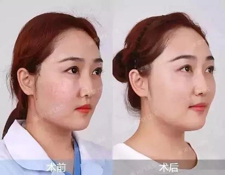 賦活水光3次399元、水光針買一送一...春季水光專場，爆款限時搶！