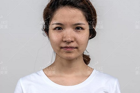 抗初老警報！萬物皆上漲、唯有臉下垂，你還說你不是老阿姨