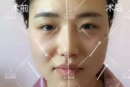 沒有誰能永遠(yuǎn)年輕，不老都是保養(yǎng)的早！