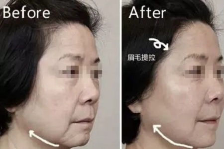 沒有誰能永遠(yuǎn)年輕，不老都是保養(yǎng)的早！