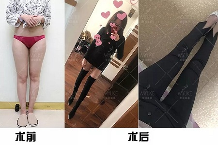 顏值：金剛?cè)绾位黹L(zhǎng)腿女神？
