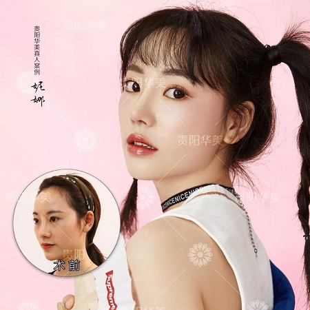 想要美眼俏鼻？來華美讓你擁有開掛人生！