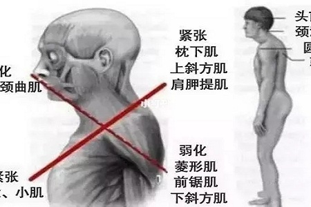 聽說很多不敢露胳膊的女生，胳膊上都有這個bug