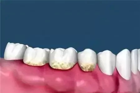 問診室：為什么我的牙卻永遠也刷不白？