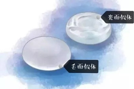 【漲知識(shí)】 解讀你較關(guān)心的假體隆胸問(wèn)題!