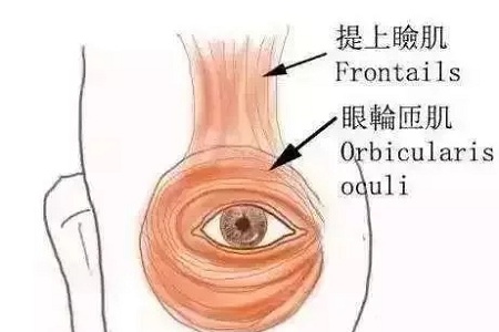 做了雙眼皮，醫(yī)師為什么建議要多睜眼？