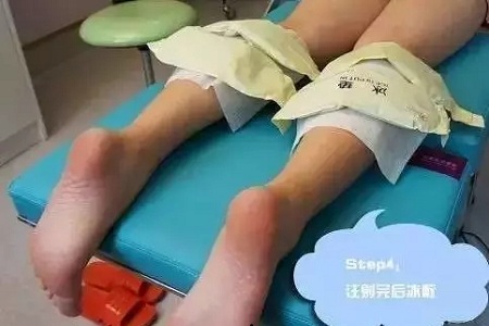 這有一個快速又持久瘦小腿的方法！請注意查收！