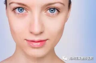 25歲以后，這些醫(yī)美項(xiàng)目可比你們的所有護(hù)膚品都強(qiáng)！