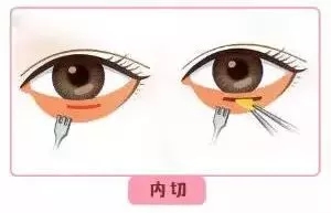 每到放假，做這個項目的人就會增多！--眼袋