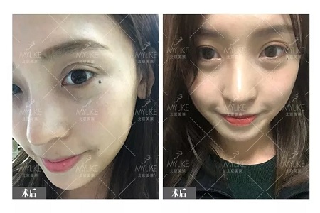 顏值：鼻子一小步，顏值一大步~