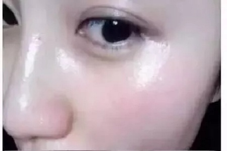 水光，打1次和4次究竟有多大區(qū)別？