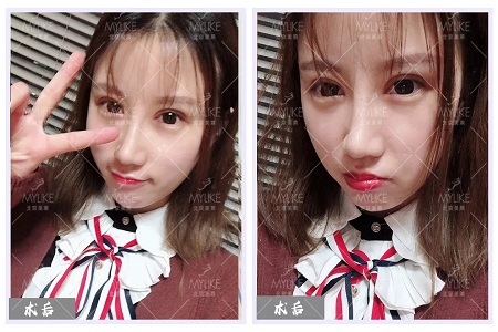 顏值：修復(fù)后的雙眼，美瞎一路