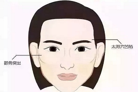 面部填充會(huì)不會(huì)把臉填大？