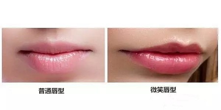 瘦臉