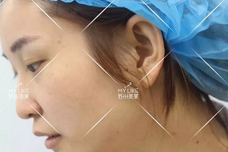 鼻子不是越高越好看！