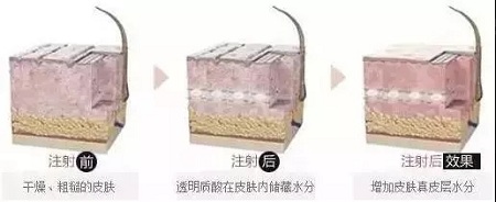 水光迎夏，“針”美麗
